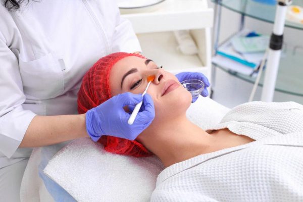 Peeling kwasem glikolowym twarzy